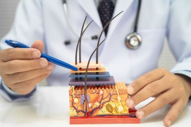 Izpadanje las in plešavost