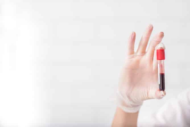 Close up of doctor hand holding blood sample. Copy space in left side