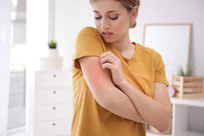 Ko koža neznosno srbi: Atopijski dermatitis