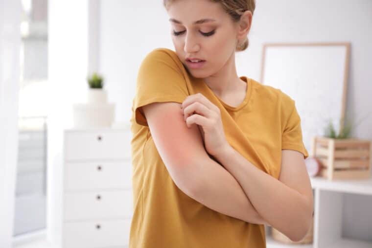Ko koža neznosno srbi: Atopijski dermatitis