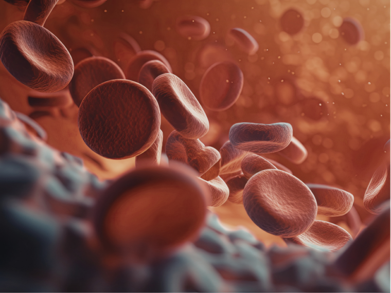 Zamašene žile: kako prepoznati simptome, kaj pomenijo in kako jih zdravimo